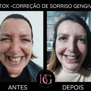 3 parceiro