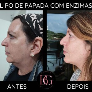 4 parceiro